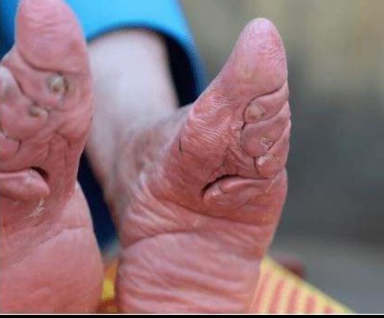 china anderson feet 6