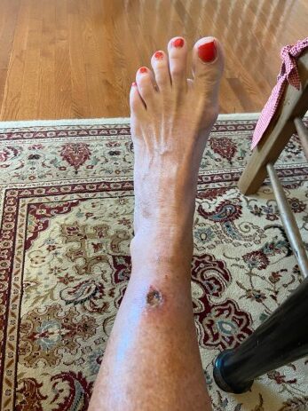 chippy lipton feet rotated