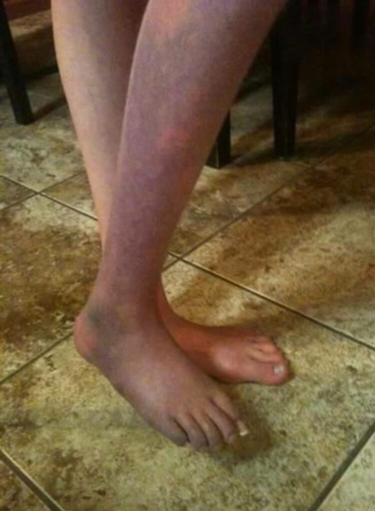 chloe greenfield feet 4