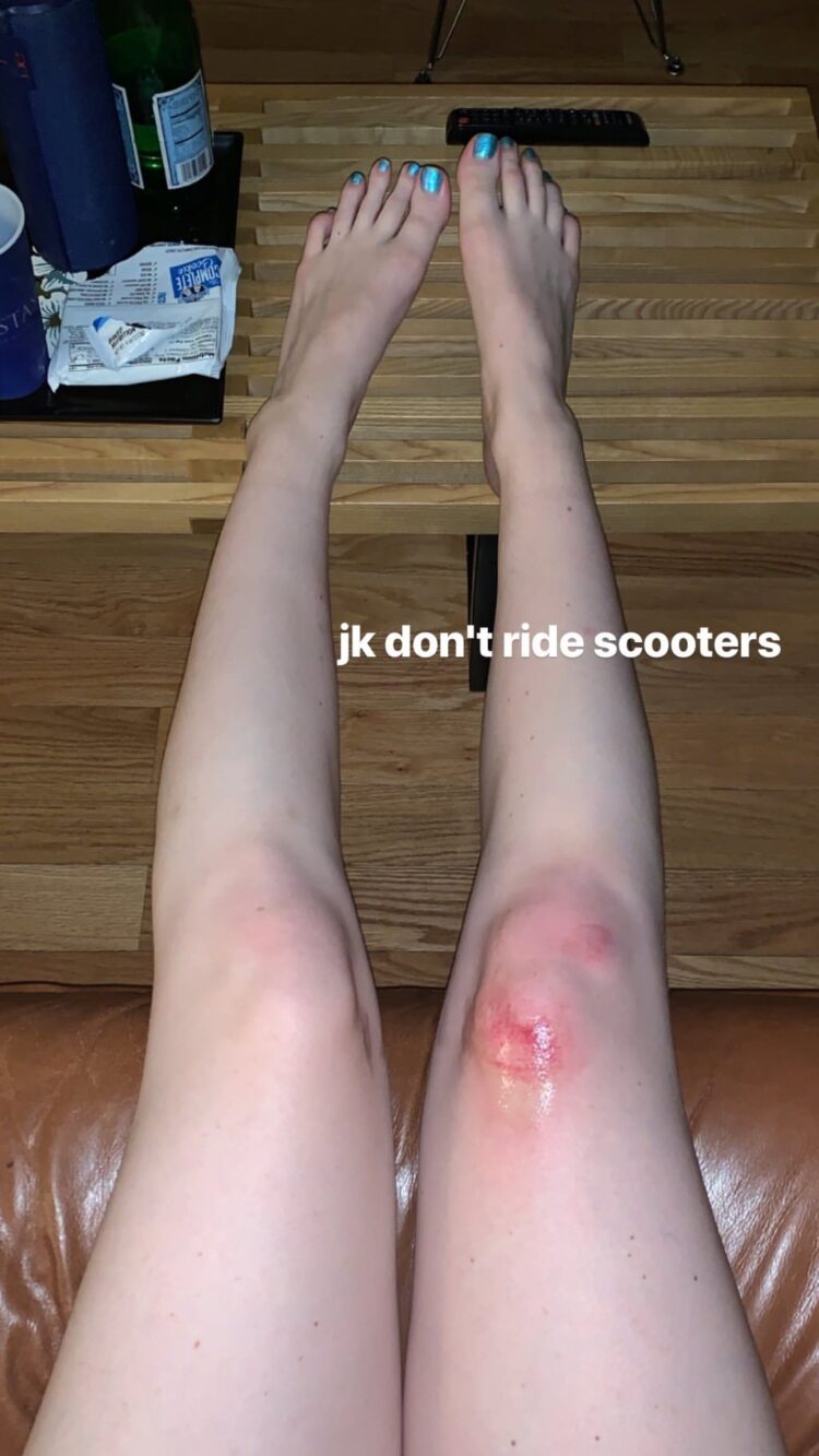 chloe kohanski feet