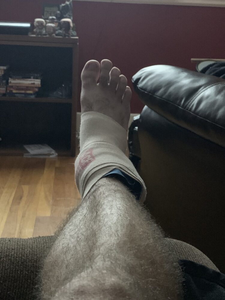 chrissy hughes feet 6