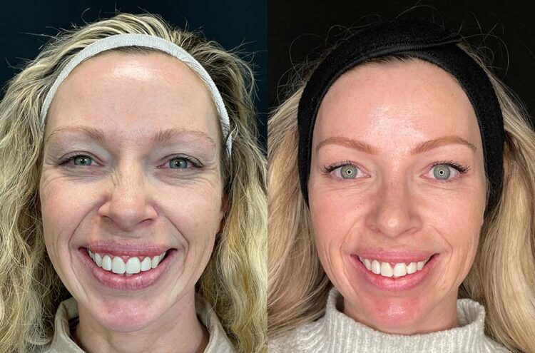 christy keane feet 5