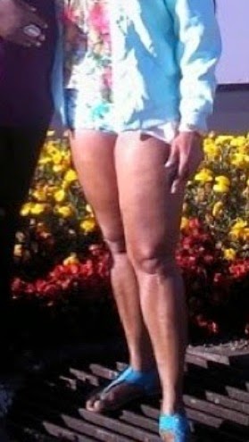 clarion chukwura feet 2