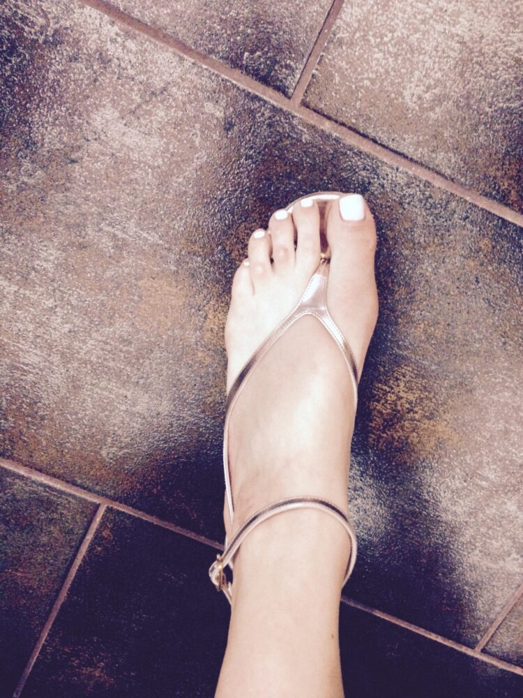 clizia incorvaia feet scaled