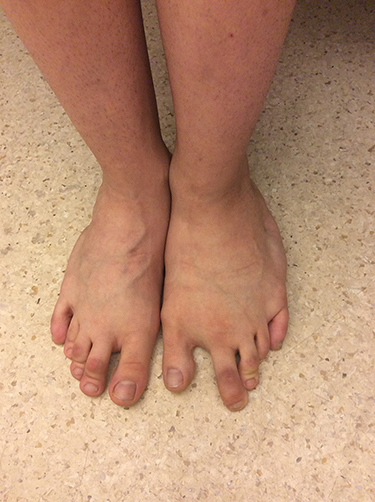 cloves feet 1