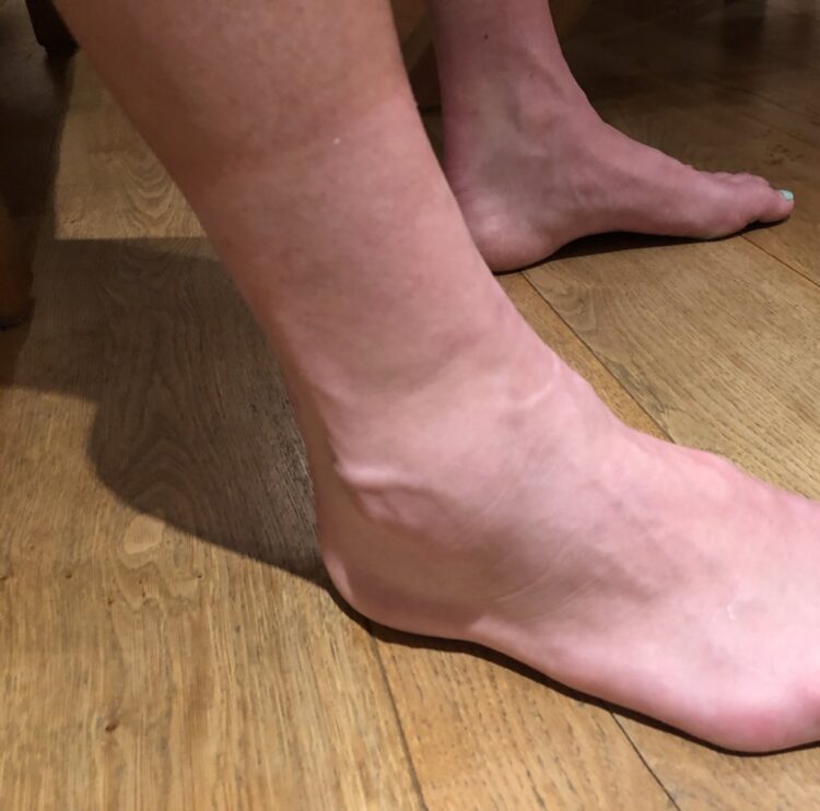 coco vandeweghe feet