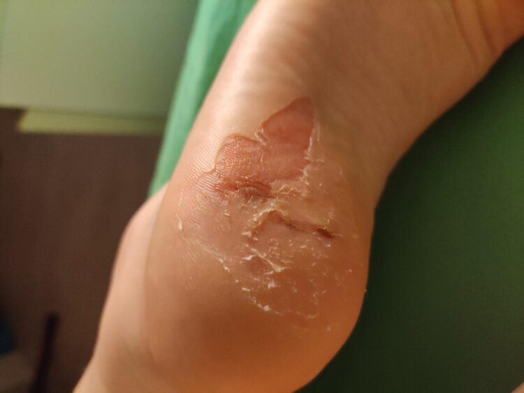 cojonaj feet 5 scaled