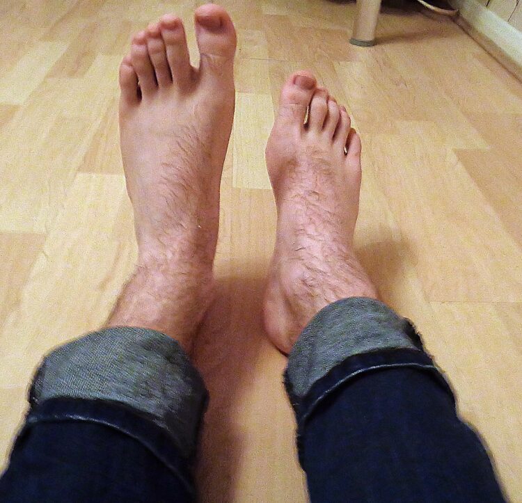 completedisorder feet 1