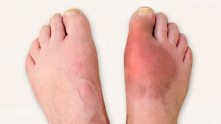 completedisorder feet
