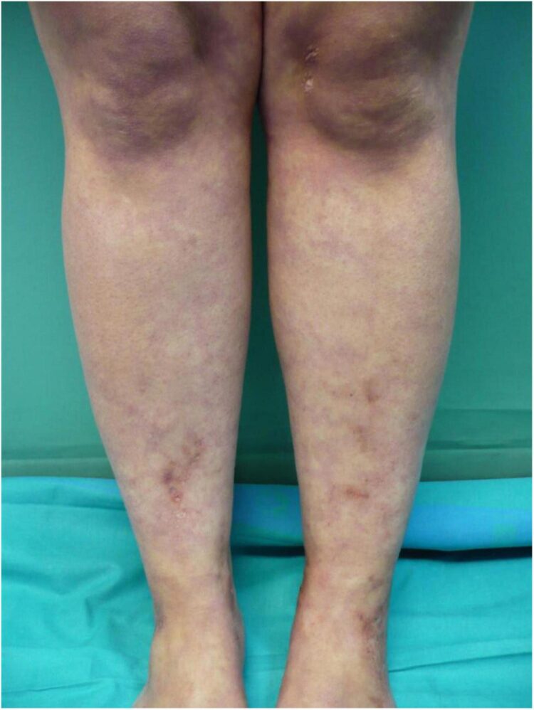 cristiane valente feet 1 scaled