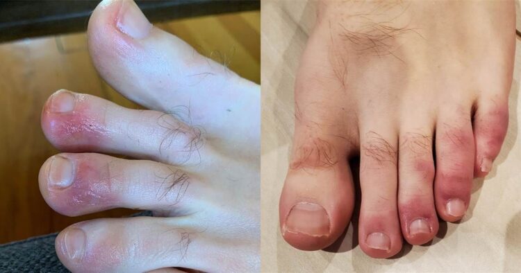 crystal lindy feet 1