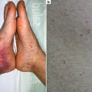 dahiara garcia feet 6