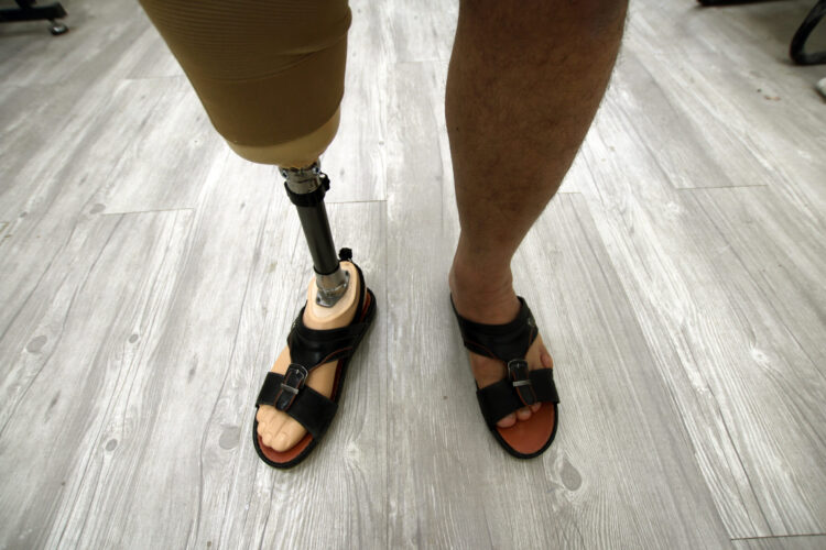 dali salih feet 2 scaled