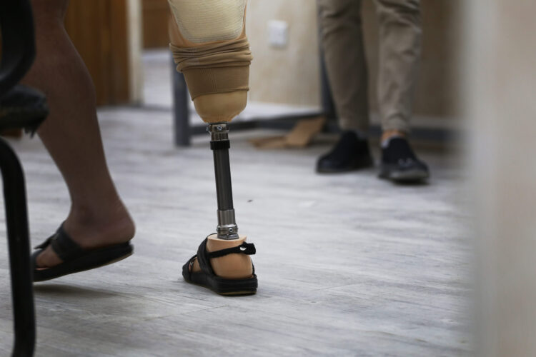 dali salih feet 6 scaled