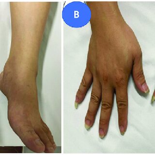 dang minh tram feet 6