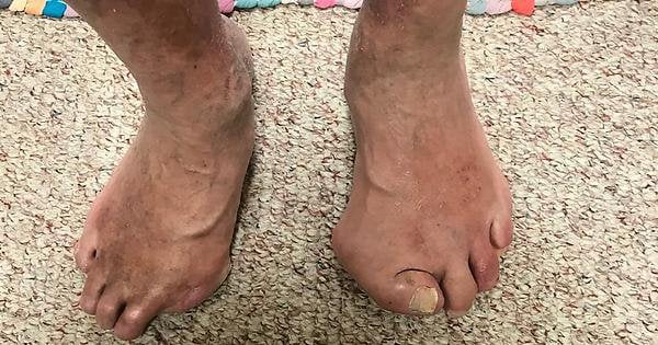 dats dynamite feet 2