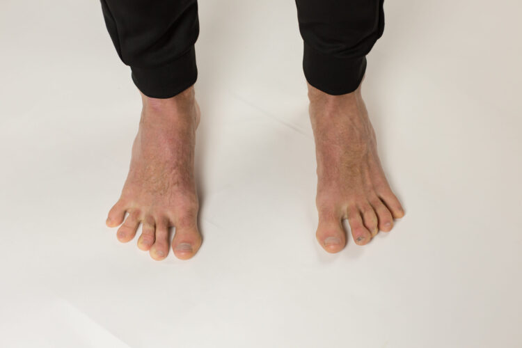 day to day by kary feet 6