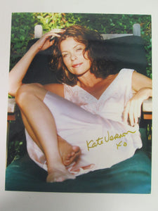 deanna dini burns feet 1