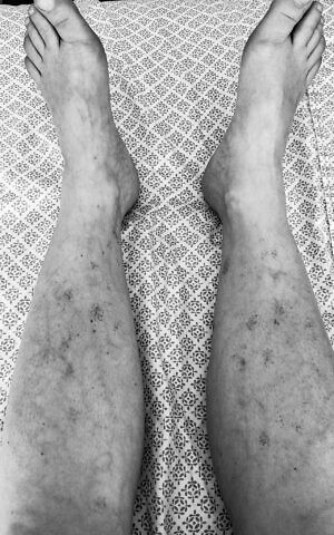 deborah copaken kogan feet 1