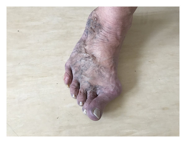 delisa stephenson feet 5