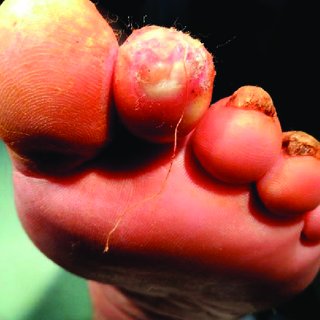 denisa stefanescu feet 5