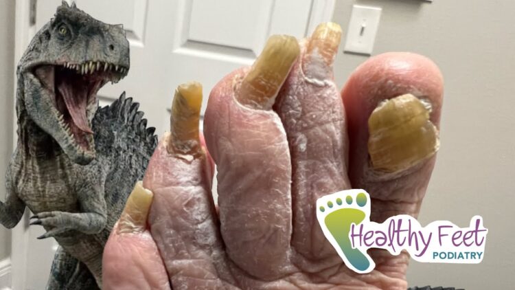 dinosaur vlogs feet 1