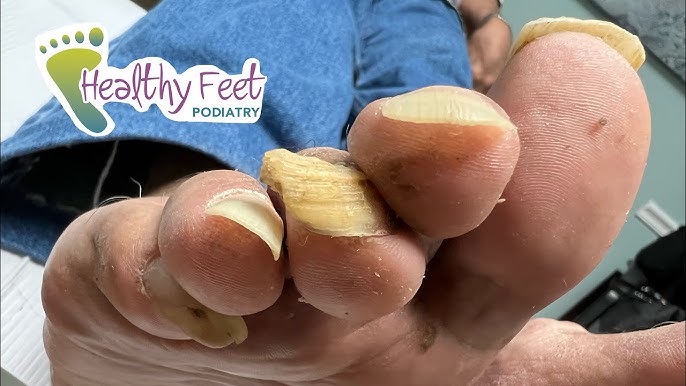 dinosaur vlogs feet 3