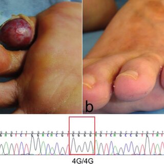 doaa el hussien feet 5