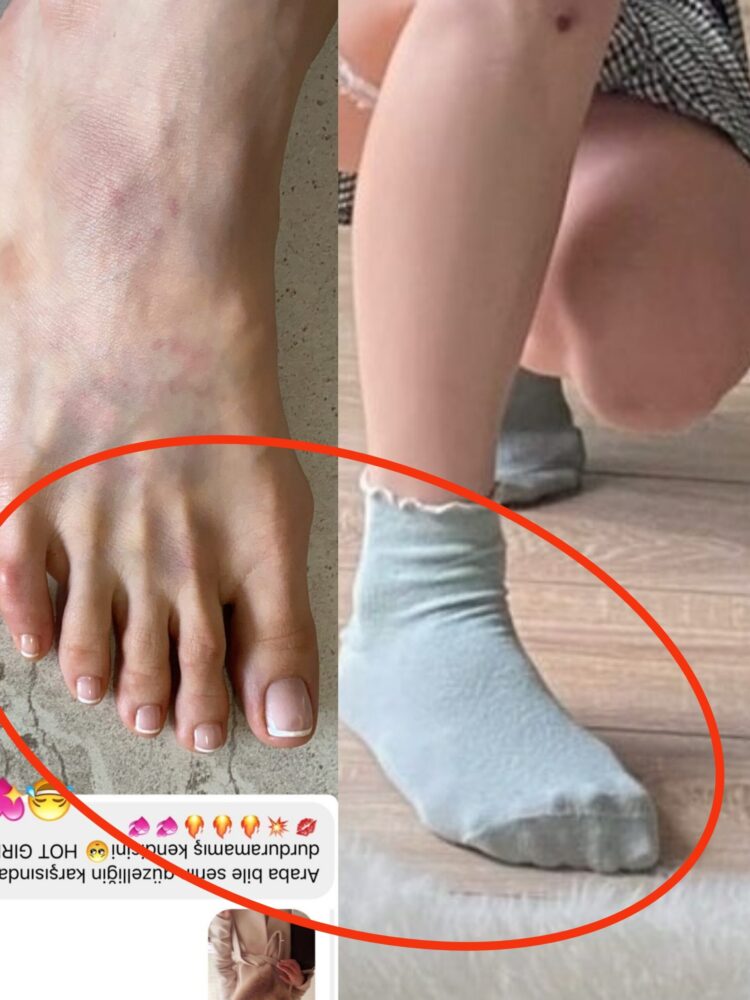 duru onver feet scaled