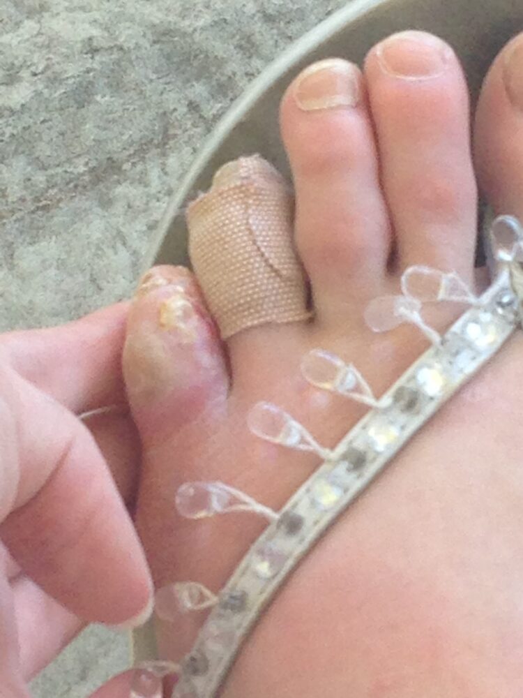 dusty button feet 4 scaled