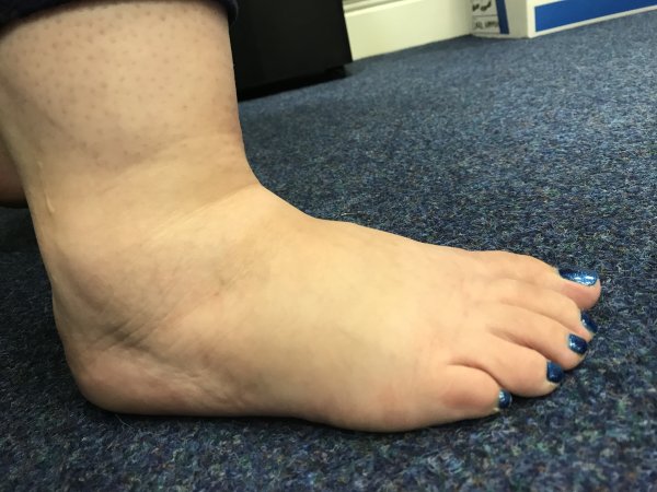 eat with chunky feet 3