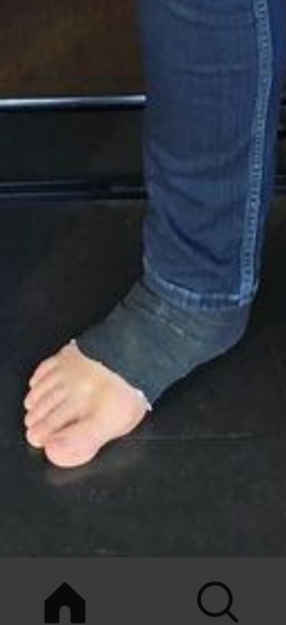 eleewiis feet 5