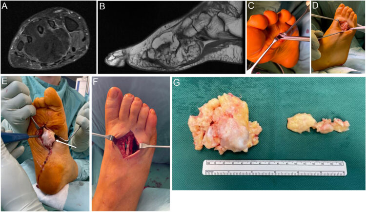 elisabeth heier werner feet 2