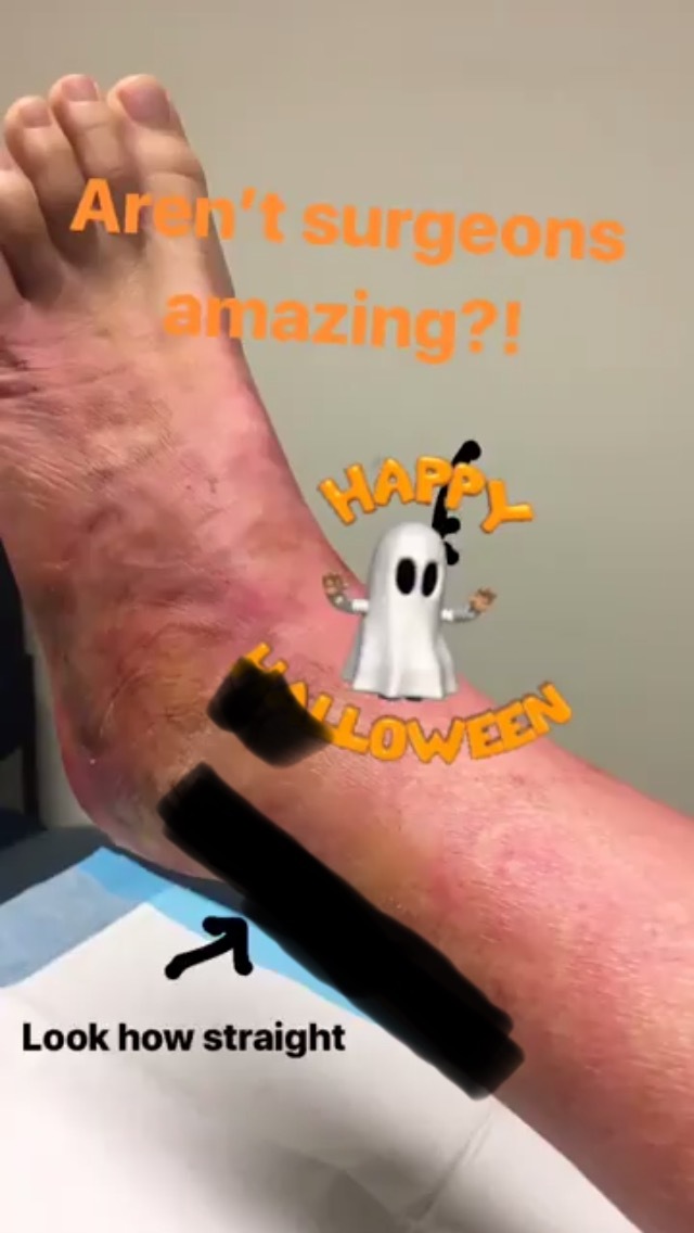 elizabeth blackmore feet 1