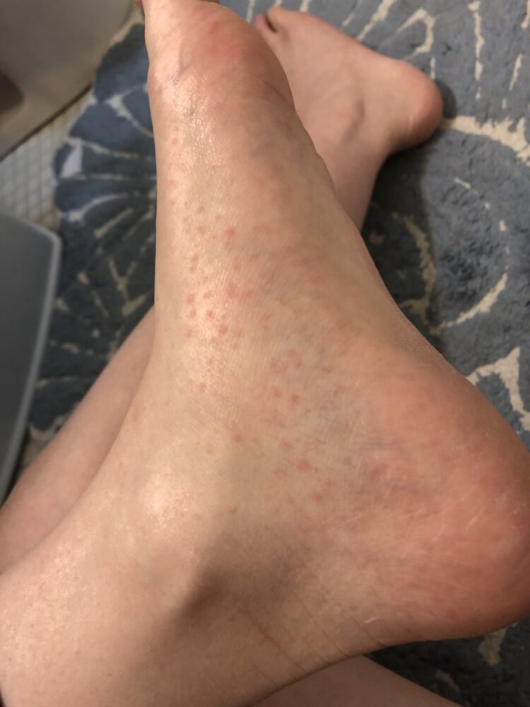 elizabeth bruenig feet 5