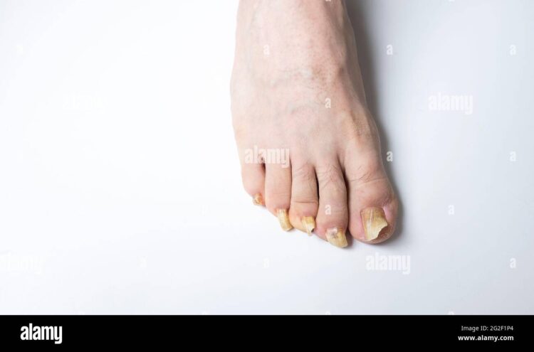 elizabeth calk feet 4