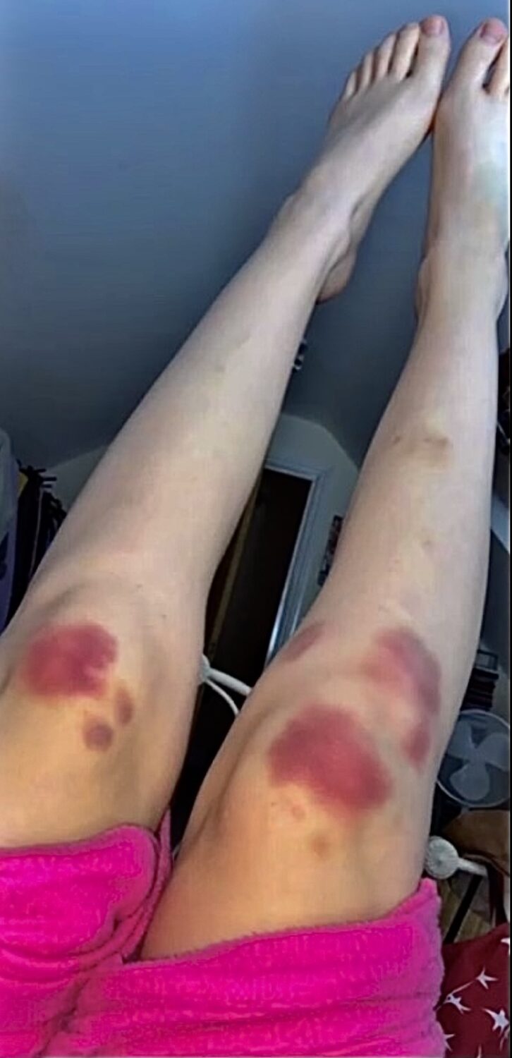 ellie bindman feet 3