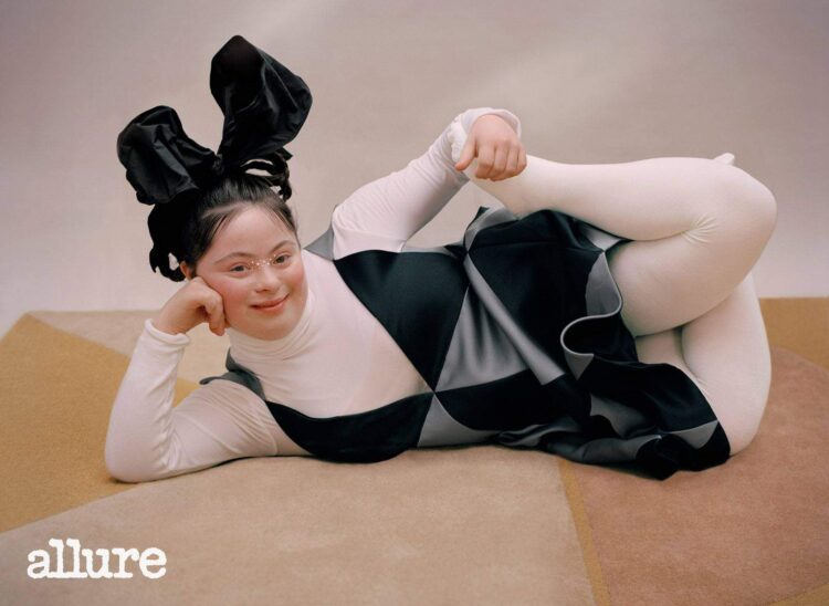 ellie goldstein feet 1