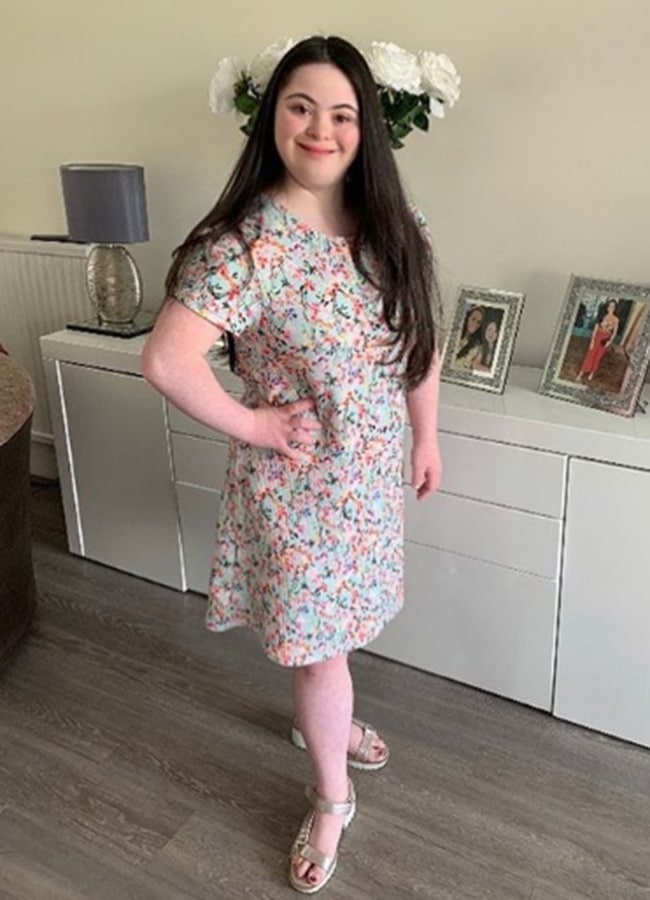 ellie goldstein feet 2