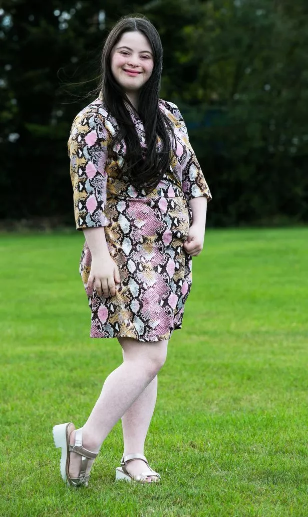 ellie goldstein feet 3