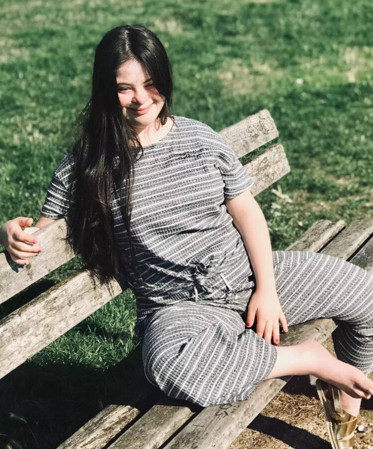 ellie goldstein feet 4