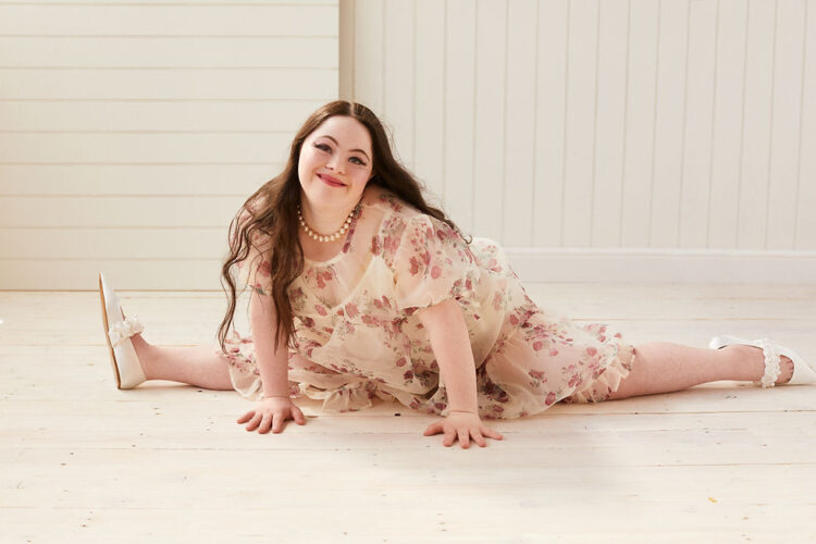 ellie goldstein feet 5