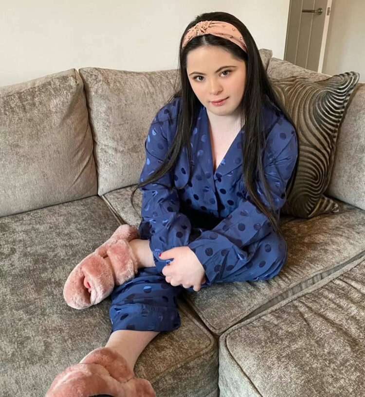 ellie goldstein feet