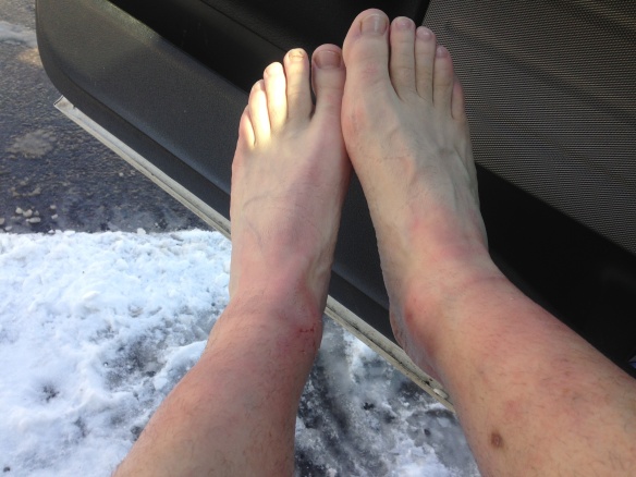 emelie forsberg feet 2