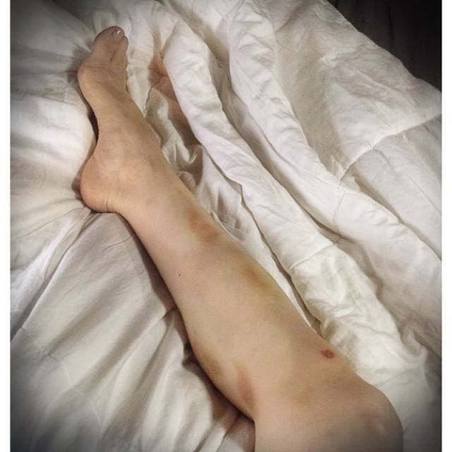 emilie autumn feet 4