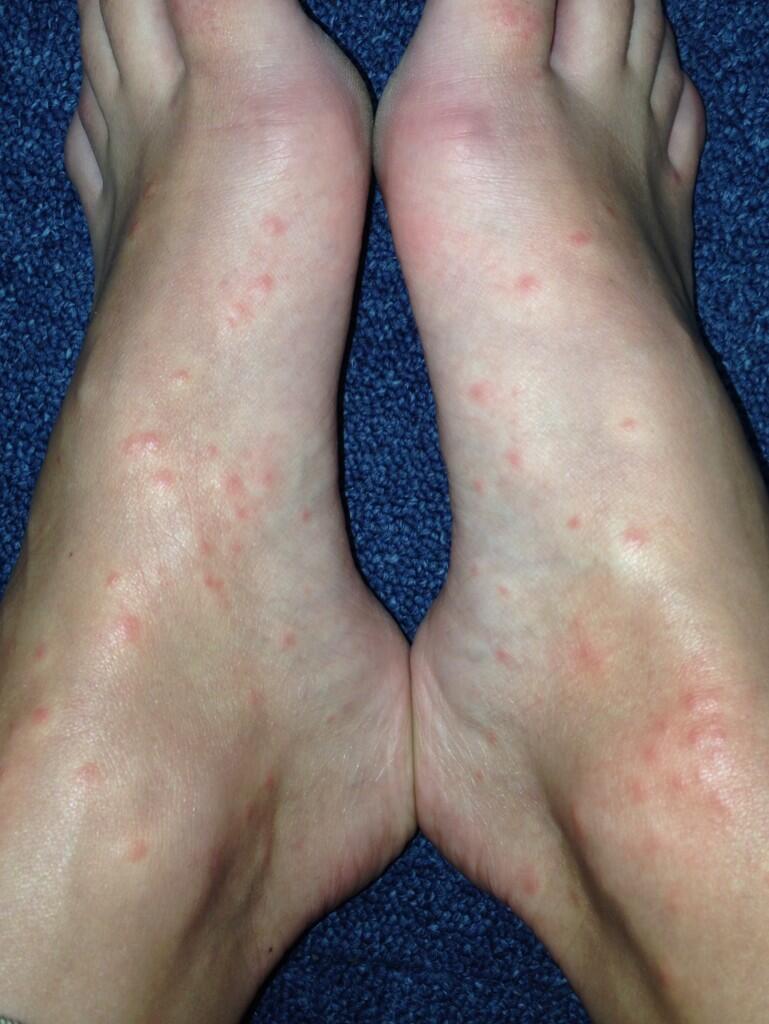 emily clarkson feet 3