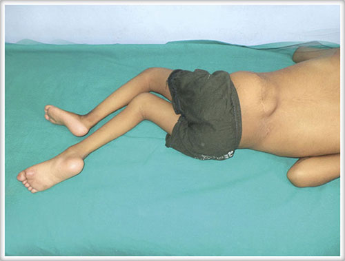 emily krumlinde feet 1