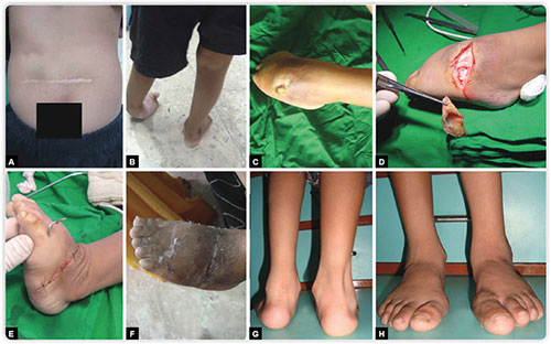 emily krumlinde feet 5