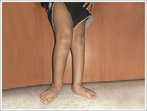 emily krumlinde feet 6