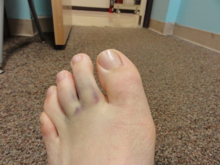 emily martenson feet 2